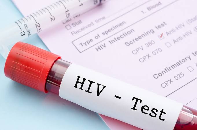 Cresce casos de HIV em Conceição do Coité; maioria são jovens