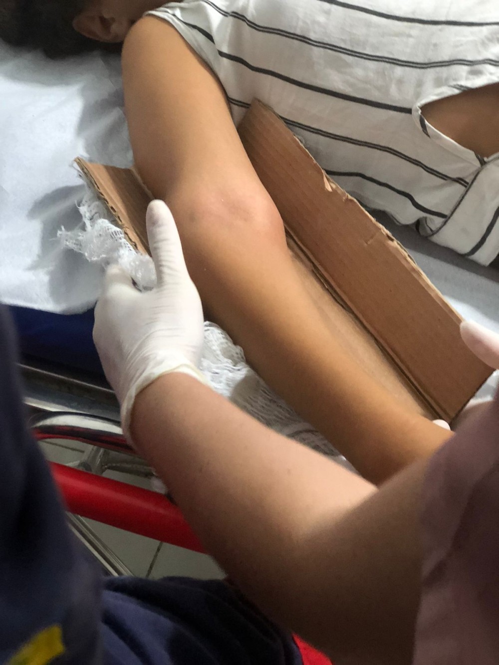 Menina sofre suspeita de fratura após cair da cadeira no bairro da Quadra em Conceição do Coité