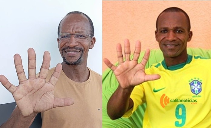 Dez dedos? Não. Doze! Coiteense que virou símbolo do Hexa mantém esperança viva e já prepara comemoração
