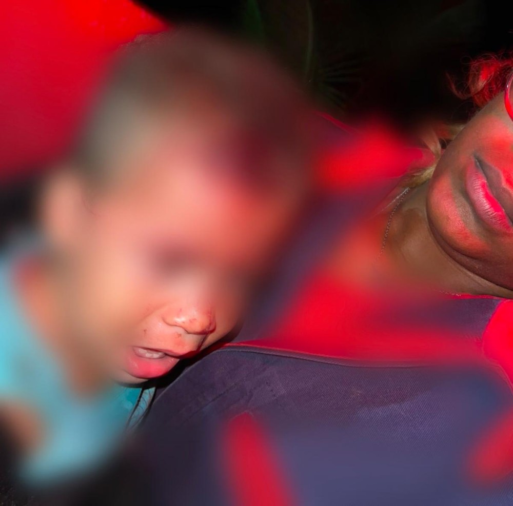 Após atingir mãe e bebê de 1 ano, motorista foge sem prestar socorro às vítimas em Conceição do Coité