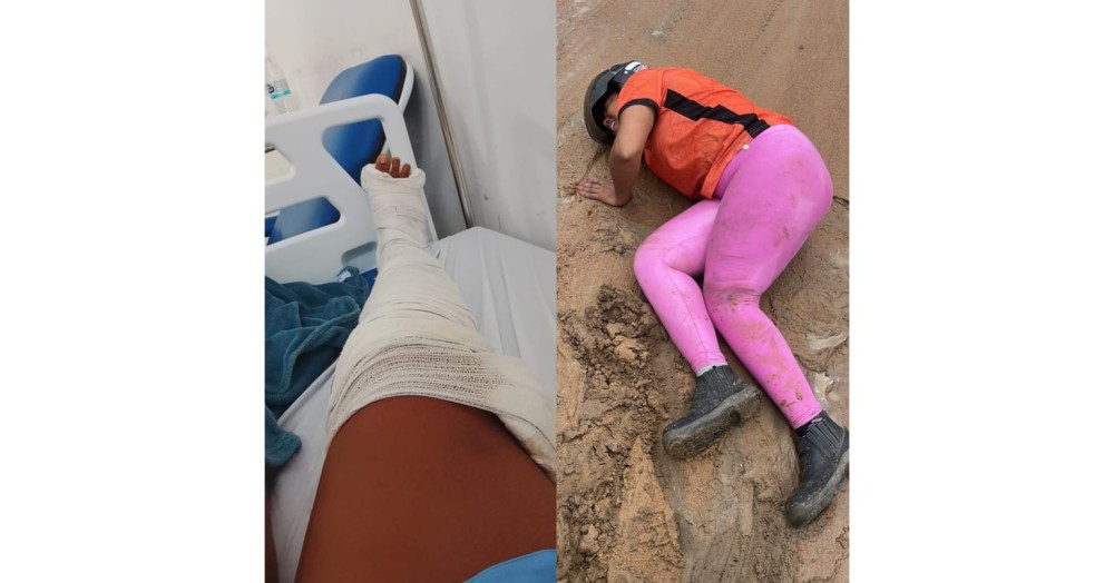 “Pelo amor de Deus, me ajudem”: após acidente, jovem coiteense completa 11 dias internada e teme perder a perna à espera de regulação