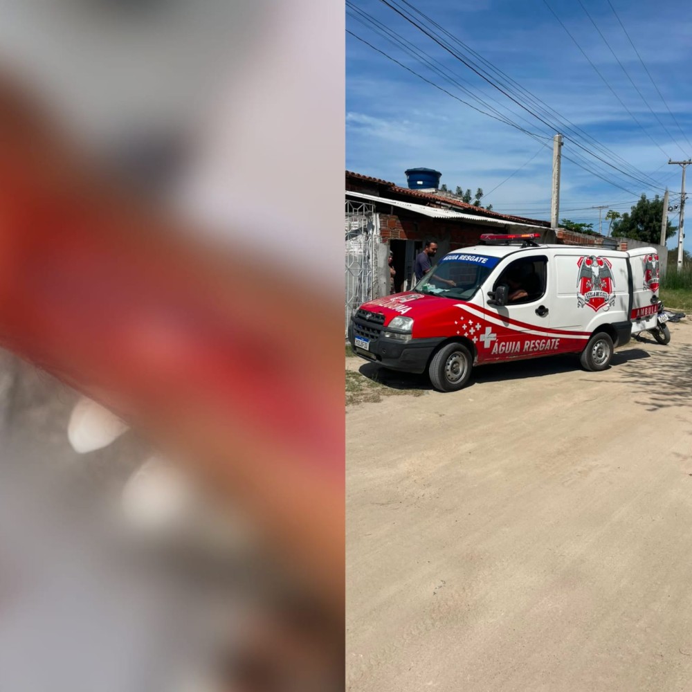 Homem sofre corte profundo na perna após disco de makita quebrar enquanto amolava enxada no bairro Casas Populares em Conceição do Coité