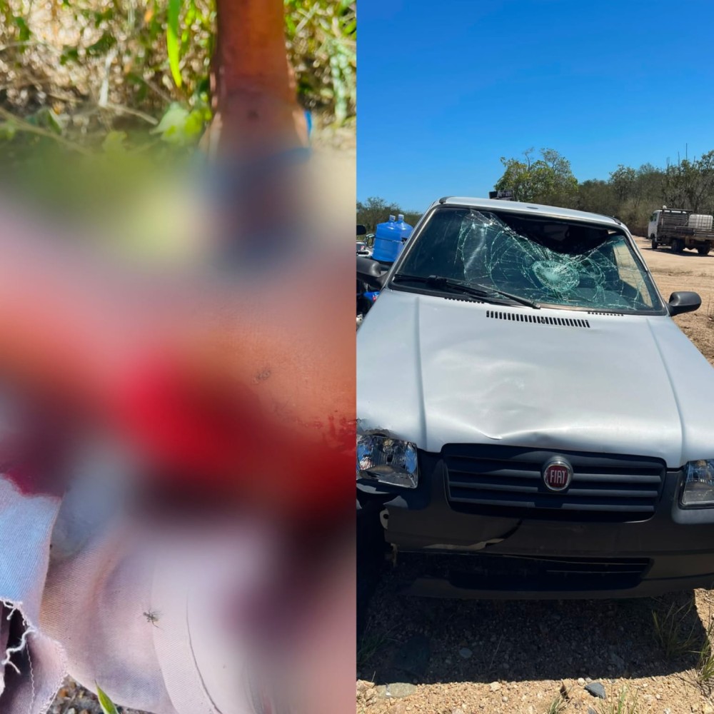 Idoso de 62 anos sofre fratura exposta após acidente na BA-409 entre Coité e Serrinha