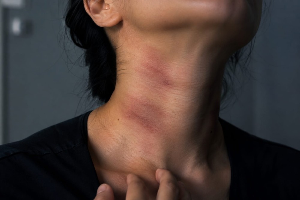 Mulher relata ter sido agredida no pescoço pelo marido no centro de Conceição do Coité