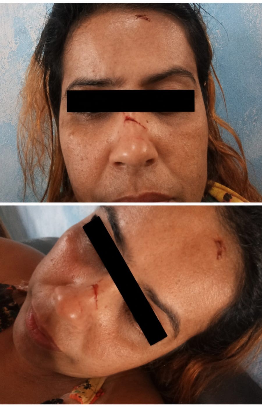 Mulher leva garrafada da ex do atual companheiro e recebe supostas ameaças: “Ainda não conheceu o inferno” em Conceição do Coité