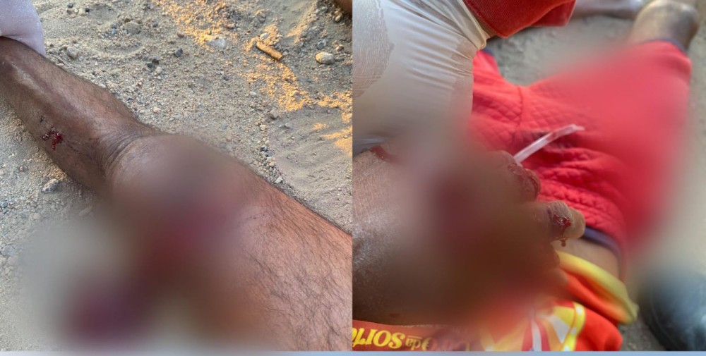 Colisão entre motos deixa homem com fraturas expostas; pai e criança de 10 anos também ficam feridos entre Conceição do Coité e Retirolândia
