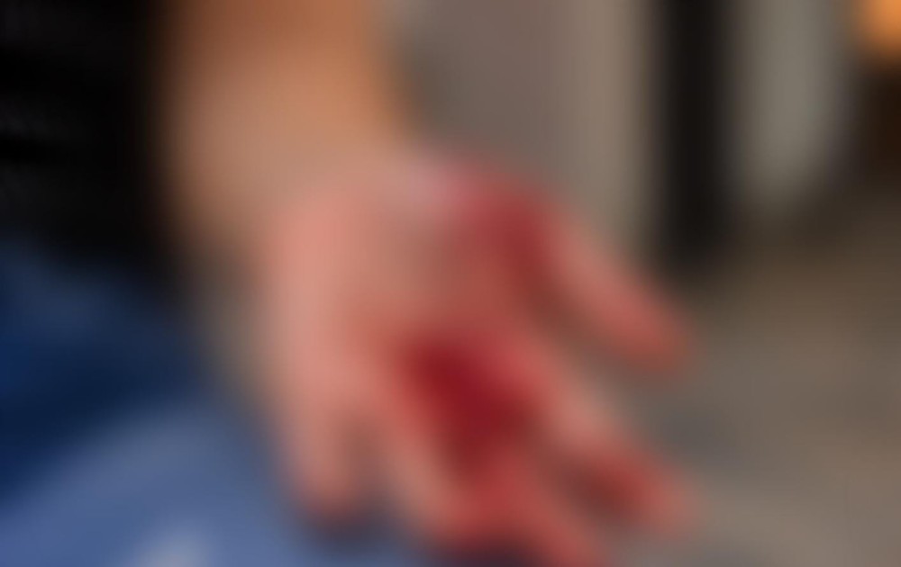 Mulher é encontrada com mão ensanguentada após suposta agressão com faca em Serrinha