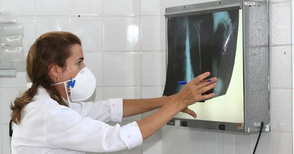 Ministério da Saúde anuncia distribuição de 70 mil medicamentos para tratar tuberculose na Bahia