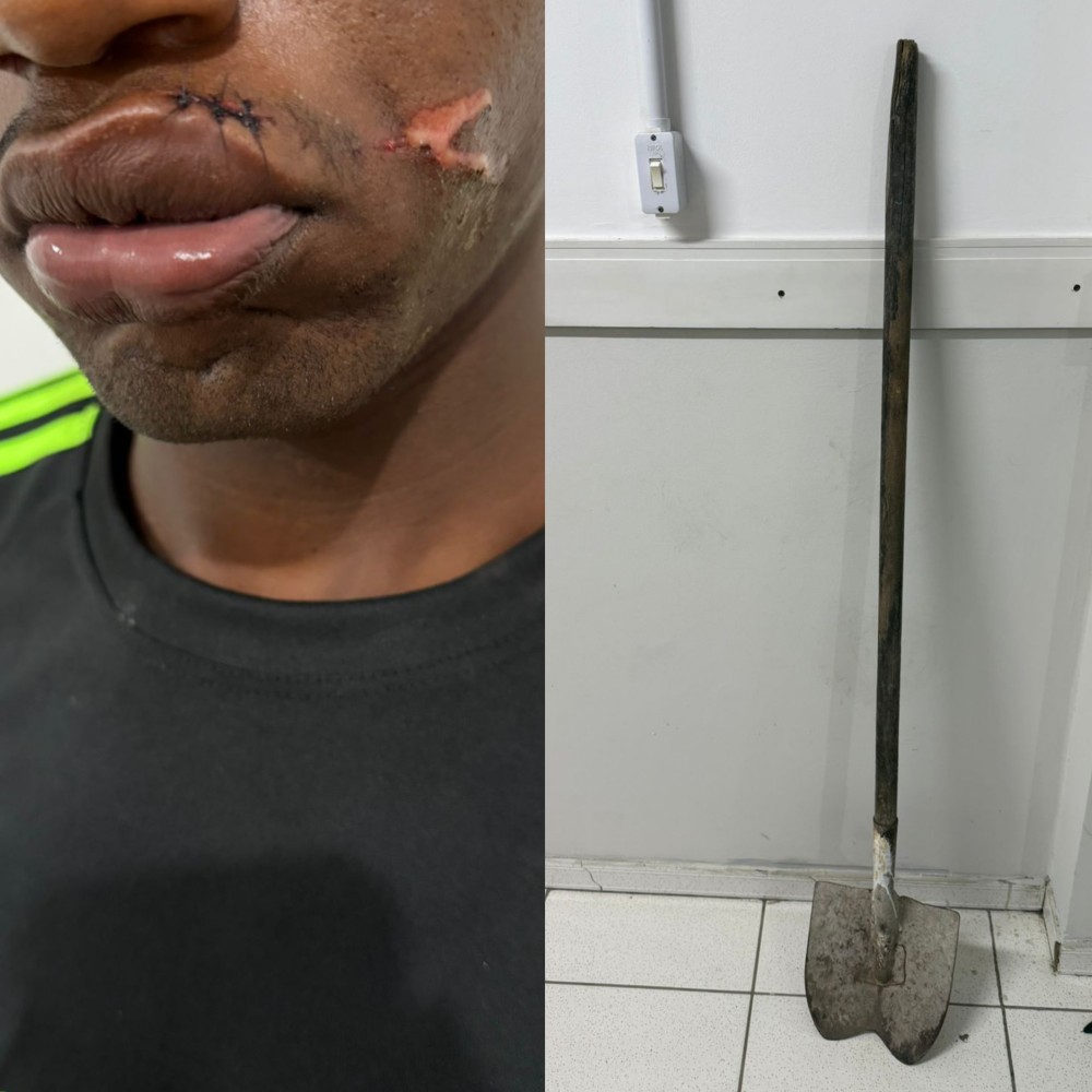 'Pazada na boca': Mulher agride companheiro após ele chegar tarde na residência em Barrocas; vítima foi socorrida ao hospital