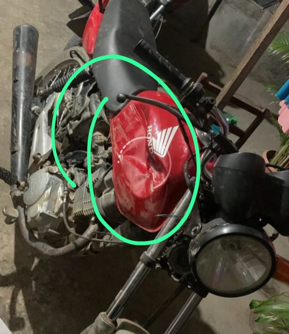 Coité: Homem sofre fratura exposta e outro fica ferido após colisão entre moto e carro em localidade próximo ao distrito de Salgadália